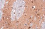 EEA1 Antibody in Immunohistochemistry (Paraffin) (IHC (P))