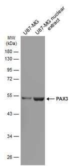 PAX3 Antibody in Western Blot (WB)