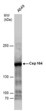 CEP164 Antibody in Western Blot (WB)