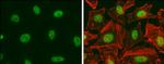 E2F1 Antibody in Immunocytochemistry (ICC/IF)