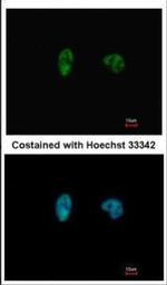 CHK2 Antibody in Immunocytochemistry (ICC/IF)