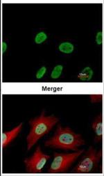 Ku70 Antibody in Immunocytochemistry (ICC/IF)