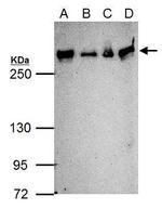 ATM Antibody in Western Blot (WB)