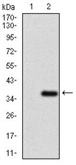 ABCG5 Antibody in Western Blot (WB)