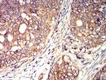 Arp3 Antibody in Immunohistochemistry (Paraffin) (IHC (P))