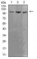 ADAR Antibody in Western Blot (WB)