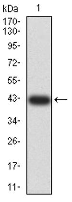 ADAR Antibody in Western Blot (WB)