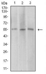 AEBP2 Antibody in Western Blot (WB)