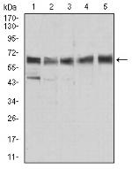 ALDH6A1 Antibody in Western Blot (WB)