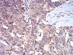 ALDH6A1 Antibody in Immunohistochemistry (Paraffin) (IHC (P))