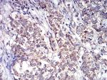 ALDH6A1 Antibody in Immunohistochemistry (Paraffin) (IHC (P))