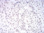 KDM1B Antibody in Immunohistochemistry (Paraffin) (IHC (P))