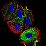 ATF3 Antibody in Immunocytochemistry (ICC/IF)