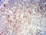 Bcl-B Antibody in Immunohistochemistry (Paraffin) (IHC (P))