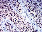 BCL9L Antibody in Immunohistochemistry (Paraffin) (IHC (P))