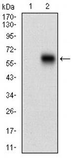 CaMKII gamma Antibody in Western Blot (WB)