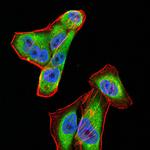 CFHR5 Antibody in Immunocytochemistry (ICC/IF)