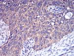 CFHR5 Antibody in Immunohistochemistry (Paraffin) (IHC (P))