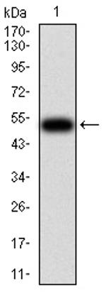 CFHR5 Antibody in Western Blot (WB)