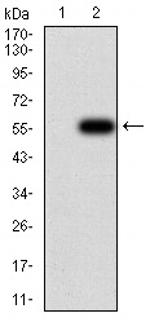 CFHR5 Antibody in Western Blot (WB)