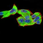 CFHR5 Antibody in Immunocytochemistry (ICC/IF)