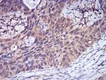 CFHR5 Antibody in Immunohistochemistry (Paraffin) (IHC (P))