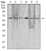 CFHR5 Antibody in Western Blot (WB)