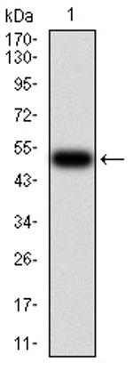 CFHR5 Antibody in Western Blot (WB)