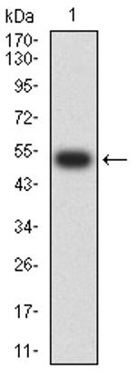 CHRNA5 Antibody in Western Blot (WB)