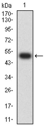 CHRNA7 Antibody in Western Blot (WB)