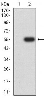 CHRNA7 Antibody in Western Blot (WB)