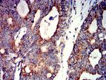 CHRNA7 Antibody in Immunohistochemistry (Paraffin) (IHC (P))