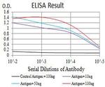 CHRNB2 Antibody in ELISA (ELISA)