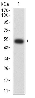 CHRNB2 Antibody in Western Blot (WB)