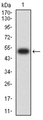 CHRNE Antibody in Western Blot (WB)