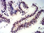 CIRBP Antibody in Immunohistochemistry (Paraffin) (IHC (P))