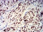 CIRBP Antibody in Immunohistochemistry (Paraffin) (IHC (P))