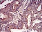 CK2 beta Antibody in Immunohistochemistry (Paraffin) (IHC (P))