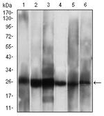 CK2 beta Antibody in Western Blot (WB)