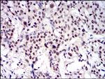 CTNNBL1 Antibody in Immunohistochemistry (Paraffin) (IHC (P))