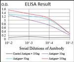 ZIPK Antibody in ELISA (ELISA)