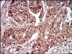 ZIPK Antibody in Immunohistochemistry (Paraffin) (IHC (P))