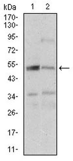 ZIPK Antibody in Western Blot (WB)