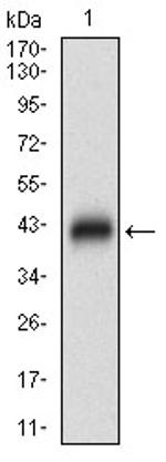 ZIPK Antibody in Western Blot (WB)