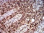 DDX1 Antibody in Immunohistochemistry (Paraffin) (IHC (P))