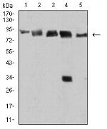 DDX1 Antibody in Western Blot (WB)