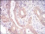 EIF2A Antibody in Immunohistochemistry (Paraffin) (IHC (P))