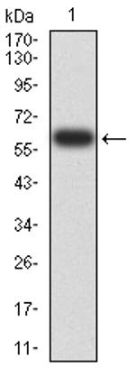 eIF5 Antibody in Western Blot (WB)