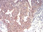 Emerin Antibody in Immunohistochemistry (Paraffin) (IHC (P))