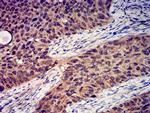 GRIK4 Antibody in Immunohistochemistry (Paraffin) (IHC (P))